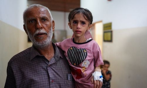 10 children per day losing one or two legs in Gaza: UNRWA