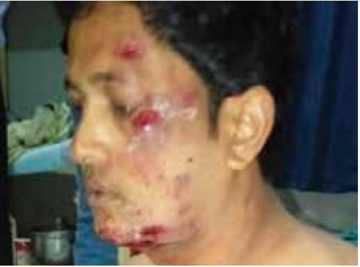 Expat beaten up by gang in Askar 