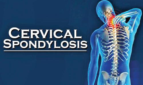 Are you suffering from Cervical Spondylosis?