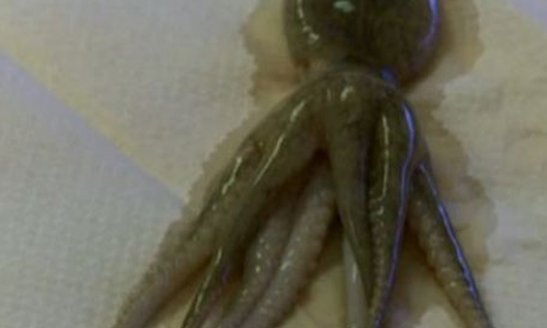 2-year-old boy found with octopus in throat