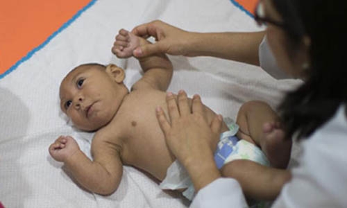 Zika-hit nations should allow access to contraception, abortion: UN