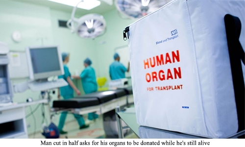 Man cut in half asks for his organs to be donated while he's still alive