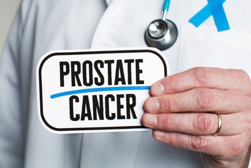 Surge in Prostate Cancer Cases in Bahrain: Statistics Reveal Alarming Trends