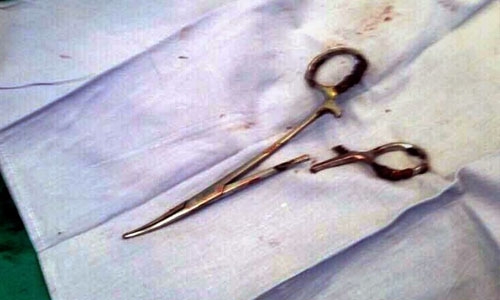 Scissors pulled from Vietnam man's stomach 18 years after surgery