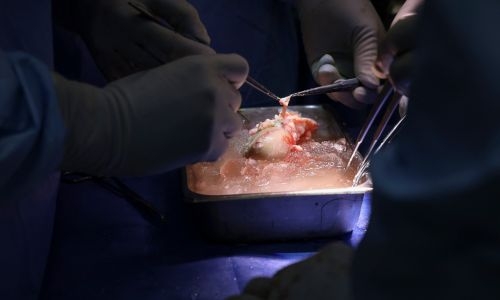 First patient to get gene-edited pig kidney transplant dies: hospital