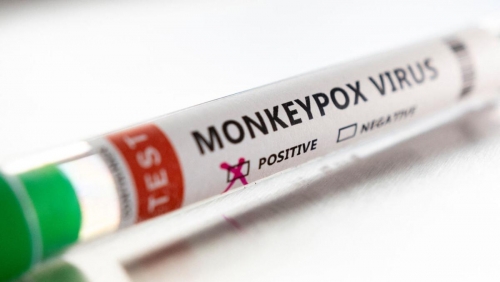 Saudi Arabia detects its first Monkeypox case
