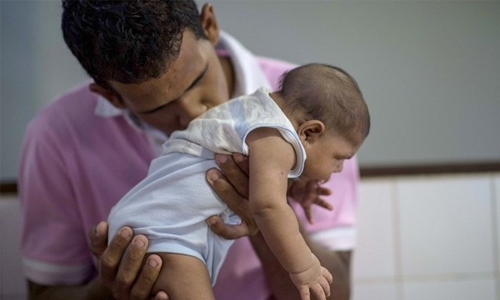 Zika babies can develop microcephaly in first year