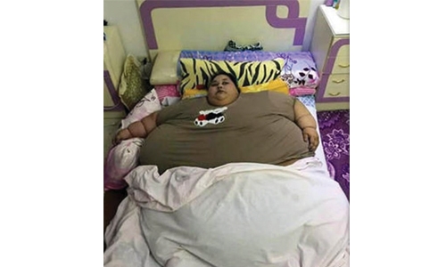 Indian doctors prepare 'world's heaviest woman' for surgery