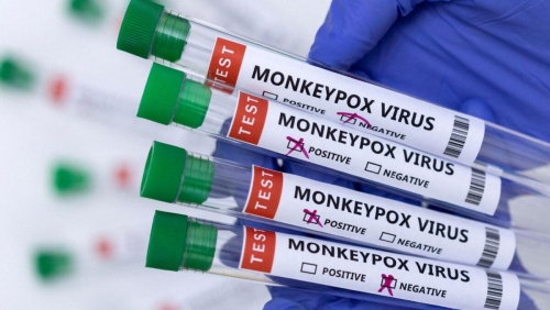 UK health agency confirms community spread of Monkeypox virus