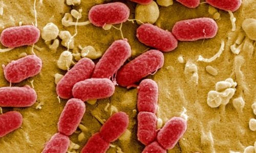 Drug-resistant superbugs to kill 39 million by 2050