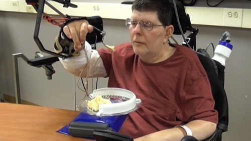 New device helps paraplegics regain partial use of hands