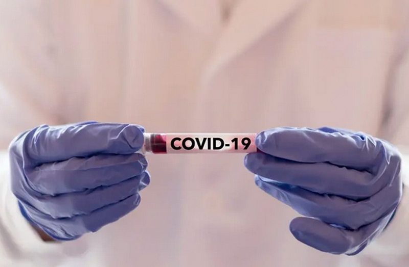 Saudi Arabia records 99 new cases of coronavirus 