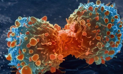 Five warning signs that show young people might have cancer