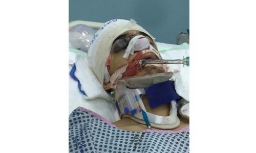Bahrain teenager injured in shootout